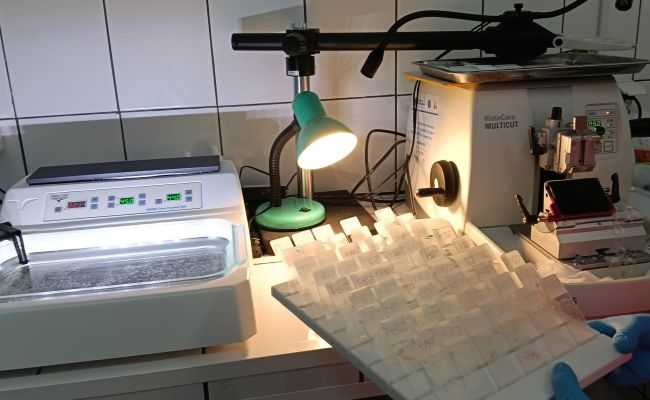 Investiții pentru sănătatea argeșenilor: Tehnologie de ultimă generație pentru diagnosticarea cancerului la Spitalul Județean Pitești!